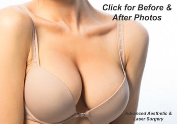 Causes of Small Breasts and Herbal Breast Enhancement Pills