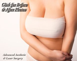 ARMSTRONG AMERIKA Post Op Breast Augmentation Band - Palestine
