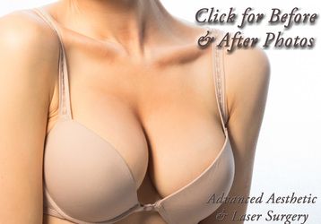 Liposuction for Breast Reduction Columbus OH