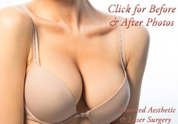 Correcting Uneven Breasts: Surgical Solutions for Breast Asymmetry