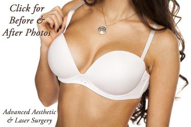 Selecting Breast Implants Shapes and Sizes Columbus OH