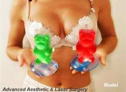 Gummy Bear Breast Implants - Holzapfel + Lied Plastic Surgery