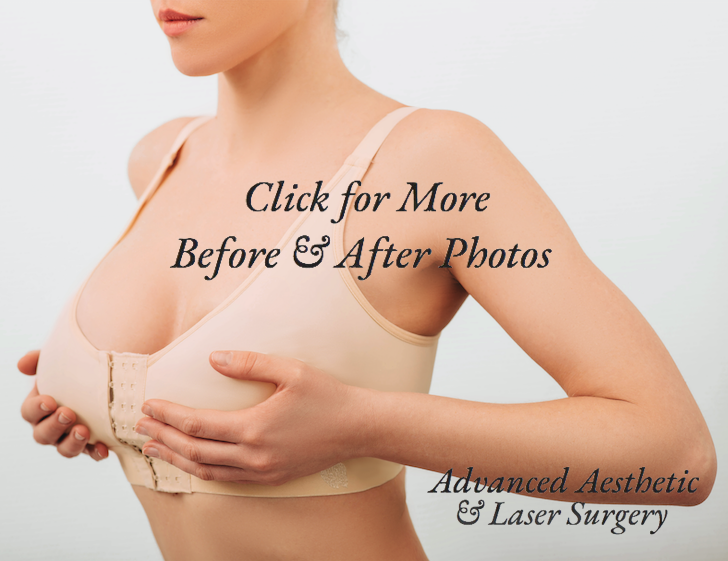 Breast Augmentation in Columbus, Ohio